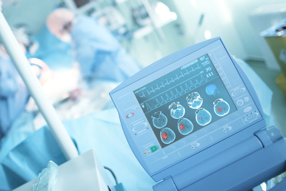 Monitor im Krankenhaus. Bei einem Schlaganfall tut sschnellstmögliche Behandlung Not.